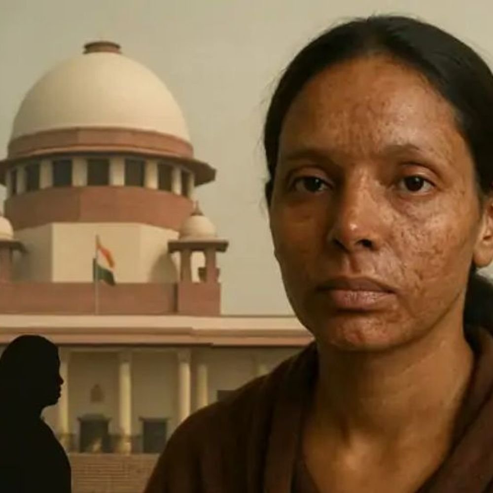 सुप्रीम कोर्ट बोला एसिड अटैक पर केंद्र सख्त कानून बनाए:आरोपियों को जब तक दर्दनाक सजा नहीं होगी, ऐसे अपराध नहीं रुकेंगे