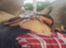 raipur breking: रायपुर में पेड़ से लटकी मिली युवती की लाश, जांच में जुटी पुलिस