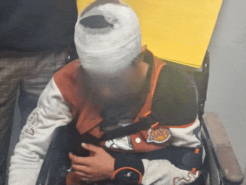 'ये कश्मीर नहीं, इन्हें मार दो' बोलकर कश्मीरियों को पीटा:देहरादून में रॉड से हाथ तोड़ा, हमलावर बोले तुमने पहलगाम में हमारे लोगों को मारा