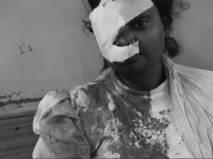 raipur bar girlfriend murder: रायपुर के बार में गर्लफ्रेंड की हत्या, बॉयफ्रेंड ने शराब की बोतल से सिर आंख फोड़ी