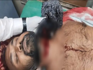 cg news: युवक ने हंसिया से काटा अपना गला, हालत गंभीर