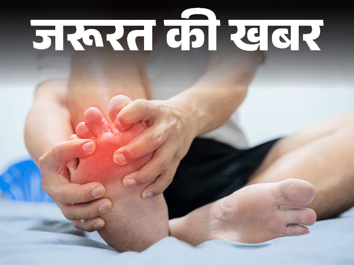 जरूरत की खबर ठंड में बढ़ता चिल ब्लेन का खतरा:उंगलियों में होता इंफ्लेमेशन, महिलाओं को रिस्क ज्यादा, डॉक्टर से जानें कैसे बचें