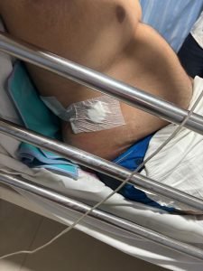 bilaspur news: भेल खाते समय कांग्रेस नेता के बेटे पर चाकू से हमला, हालत गंभीर; आरोपी फरार