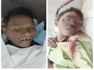 raigarh pickup accident: सगाई से लौट रही पिकअप खाई में गिरी; 4 की मौत, 20 घायल