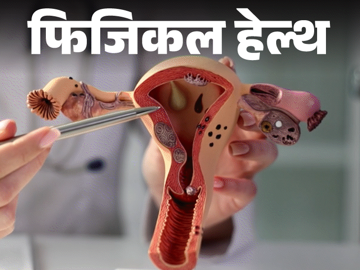 फिजिकल हेल्थ बार–बार हैवी पीरियड्स:हो सकता है यूटेरिन फाइब्रॉइड, डॉक्टर से जानें ये क्या है, इन 12 लक्षणों को इग्नोर न करें