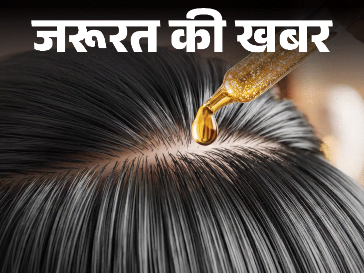 जरूरत की खबर क्या बालों में ऑयलिंग से बढ़ता डैंड्रफ:क्या है सही तरीका, हेयर प्रोटेक्शन के 12 टिप्स, बता रहे हैं डर्मेटोलॉजिस्ट