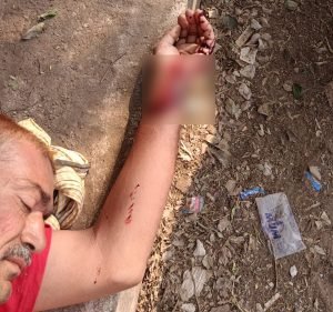 raipur breaking: रायपुर में सनकी पति ने पत्नी को हथौड़े से मारा, बचाने आए सास ससुर पर भी हमला; फिर खुद भी काटी कलाई