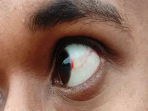 cg breaking: स्कूल में मोबाइल लाने पर टीचर ने स्टूडेंट के प्राइवेट पार्ट पर मारी लात; आंख कान से निकला खून