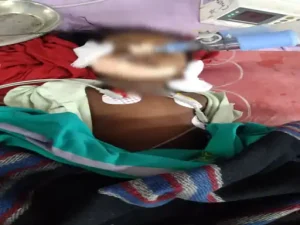 cg breaking: मेडिकल कॉलेज में इंजेक्शन लगते ही बिगड़ी तबीयत, 13 महीने की बच्ची की मौत