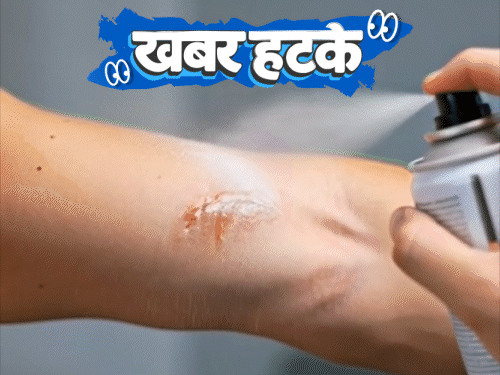 खबर हटके 1 सेकेंड में घाव ठीक करेगा स्प्रे:लोगों के खाते में रातोंरात ₹3.62 लाख करोड़ आए; बिना सिग्नल 124 सालों से चल रही ट्रेन