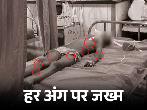 5 कुत्तों ने बच्चे को नोच नोचकर मार डाला:शरीर के हर हिस्से पर काटा, पिता ने छुड़वाया; जालंधर में मां संग खेत पर गया था