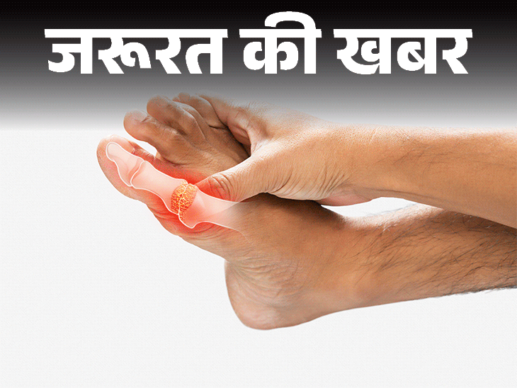 जरूरत की खबर क्या आपका यूरिक एसिड बढ़ा है:इन 9 संकेतों से पहचानें, जानें बिना दवाई कैसे करें कंट्रोल, क्या खाएं और क्या न खाएं