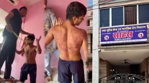 raipur news: रायपुर में नशा मुक्ति केंद्र में युवक से बर्बरता, आदिवासी युवक को बेरहमी से पीटा