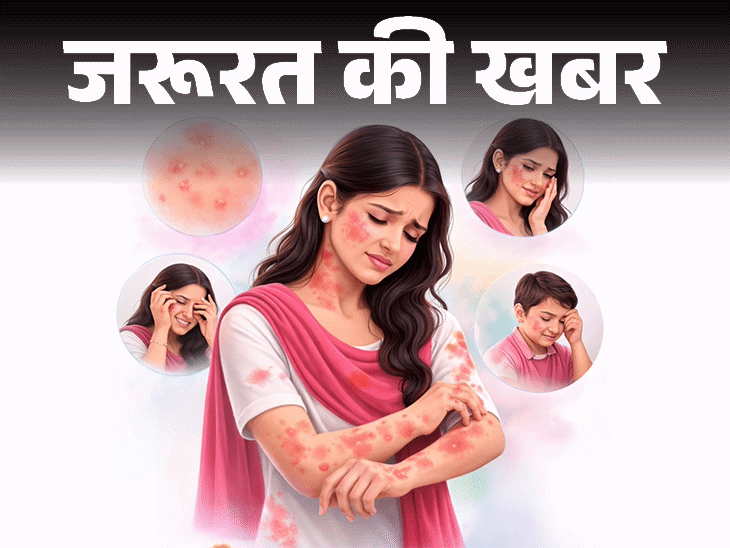 जरूरत की खबर होली रंगों से स्किन पर रैशेज, दाने:डर्मेटोलॉजिस्ट से जानें 10 घरेलू इलाज, ये 6 संकेत दिखें तो तुरंत डॉक्टर को दिखाएं