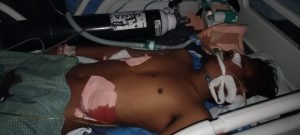 raipur chakubaji: रायपुर में चाकूबाजी, पैसों के विवाद में युवक पर ताबड़तोड़ हमला; हालत नाजुक